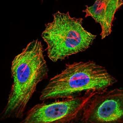 Immunocytochemistry/ Immunofluorescence: Glypican 3 Antibody (9C2) - BSA Free [NBP2-37483]