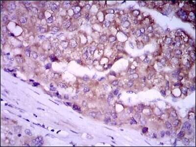 Immunohistochemistry-Paraffin: Glypican 3 Antibody (9C2) - BSA Free [NBP2-37483]