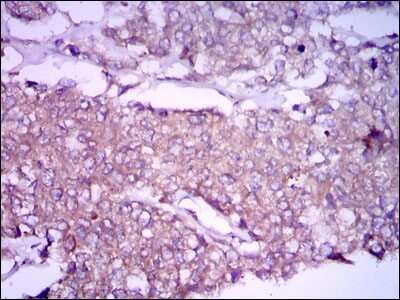 Immunohistochemistry-Paraffin: Glypican 3 Antibody (9C2) - BSA Free [NBP2-37483]