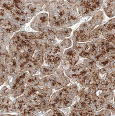 Immunohistochemistry-Paraffin: Glypican 3 Antibody (CL12711) [NBP3-18542]
