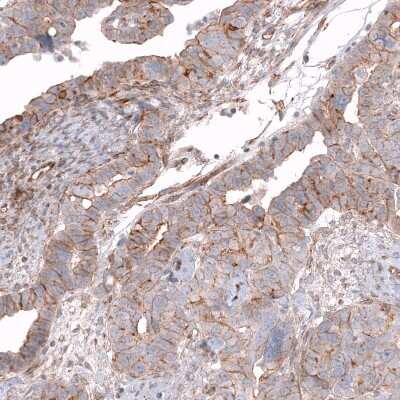 Immunohistochemistry-Paraffin: Glypican 3 Antibody (CL12711) [NBP3-18542]