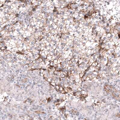 Immunohistochemistry-Paraffin: Glypican 3 Antibody (CL12711) [NBP3-18542]