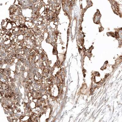 Immunohistochemistry-Paraffin: Glypican 3 Antibody (CL12711) [NBP3-18542]