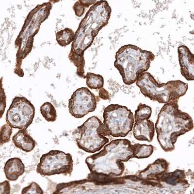 Immunohistochemistry-Paraffin: Glypican 3 Antibody (CL12711) [NBP3-18542]