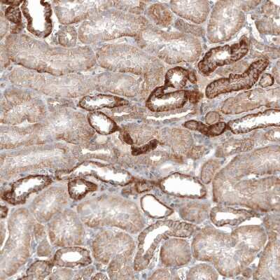 Immunohistochemistry-Paraffin: Glypican 3 Antibody (CL12711) [NBP3-18542]