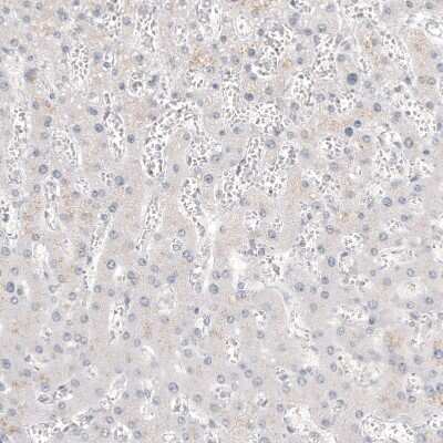Immunohistochemistry-Paraffin: Glypican 3 Antibody (CL12711) [NBP3-18542]
