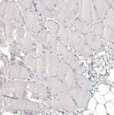 Immunohistochemistry-Paraffin: Glypican 3 Antibody (CL12711) [NBP3-18542]