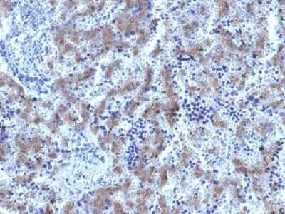 Immunohistochemistry-Paraffin: Glypican 3 Antibody (GPC3/1534R) - Azide and BSA Free [NBP2-54468]
