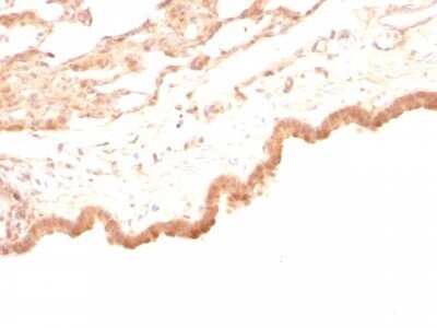 Immunohistochemistry-Paraffin: Glypican 3 Antibody (GPC3/863) - Azide and BSA Free [NBP2-47762]