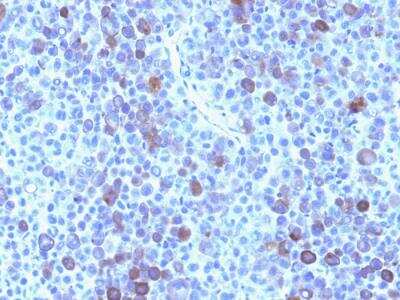 Immunohistochemistry-Paraffin: Glypican 3 Antibody (GPC3/863) - IHC-Prediluted [NBP2-48398]