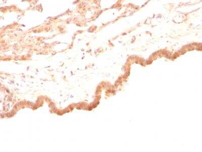 Immunohistochemistry-Paraffin: Glypican 3 Antibody (GPC3/863) - IHC-Prediluted [NBP2-48398]