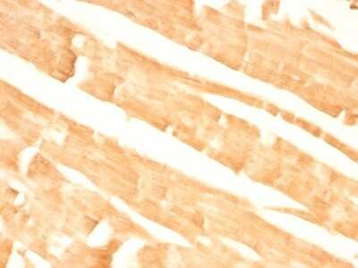 Immunohistochemistry-Paraffin: Glypican 3 Antibody (GPC3/863) [NBP2-44486]