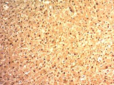Immunohistochemistry-Paraffin: Glypican 3 Antibody (SPM595) - IHC-Prediluted [NBP2-48397]
