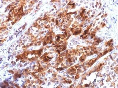 Immunohistochemistry-Paraffin: Glypican 3 Antibody (rGPC3/863) [NBP2-53141]