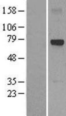 Western Blot: Glypican 6 Overexpression Lysate [NBL1-11223]