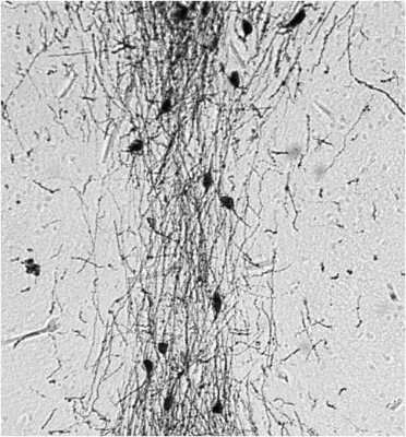 Immunohistochemistry-Paraffin: GnRH Antibody [NB300-506]