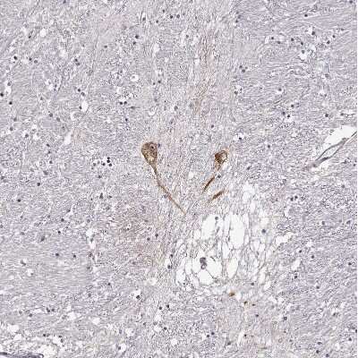 Immunohistochemistry-Paraffin: GnRH Antibody [NBP1-89749]