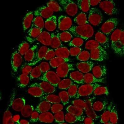 Immunocytochemistry/ Immunofluorescence: GnRHR Antibody (F1G4) [NBP2-45298]