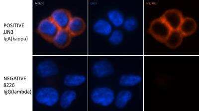 Immunocytochemistry/ Immunofluorescence: Goat anti-Human Kappa Light Chain Secondary Antibody [NB7463]