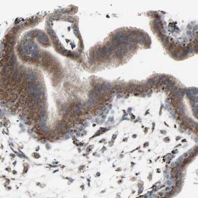 Immunohistochemistry-Paraffin: Golgi Glycoprotein 1/GLG1 Antibody [NBP1-90636]