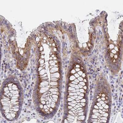 Immunohistochemistry-Paraffin: Golgin 97 Antibody [NBP2-38528]