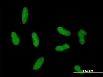 Immunocytochemistry/ Immunofluorescence: Gonadotropin Inducible Transcription Repressor 1 Antibody [H00092283-B01P]
