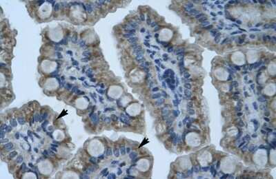 Immunohistochemistry-Paraffin: Gonadotropin Inducible Transcription Repressor 1 Antibody [NBP1-80177]