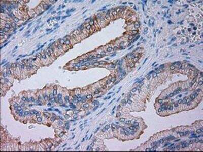 Immunohistochemistry-Paraffin: Goosecoid Antibody (OTI1D7) [NBP1-47790]