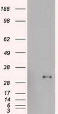 Western Blot: Goosecoid Antibody (OTI1D7) [NBP1-47790]