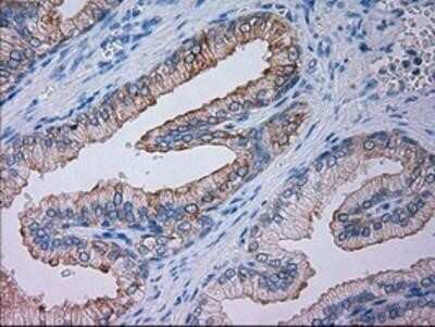 Immunohistochemistry: Goosecoid Antibody (OTI1D7) - Azide and BSA Free [NBP2-72409]