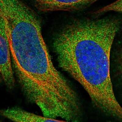 Immunocytochemistry/ Immunofluorescence: Grancalcin Antibody [NBP1-89785]