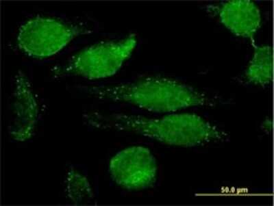 Immunocytochemistry/ Immunofluorescence: Granulin Antibody (1F5) [H00002896-M01]