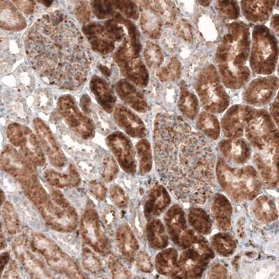 Immunohistochemistry-Paraffin: Granulin Antibody (CL5692) [NBP2-61424]