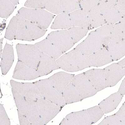Immunohistochemistry-Paraffin: Granulin Antibody (CL5695) [NBP2-61425]
