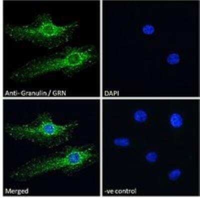 Immunocytochemistry/ Immunofluorescence: Granulin Antibody [NBP1-26396]