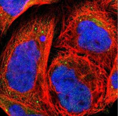 Immunocytochemistry/ Immunofluorescence: Granulin Antibody [NBP1-87324]