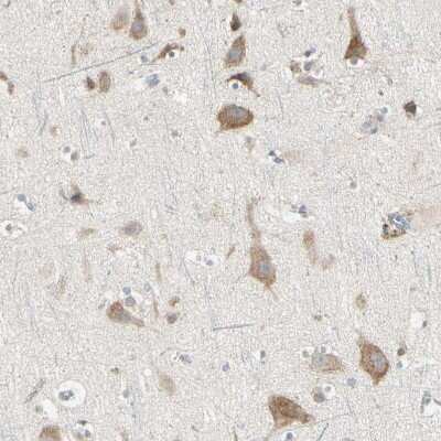 Immunohistochemistry-Paraffin: Granulin Antibody [NBP1-87324]