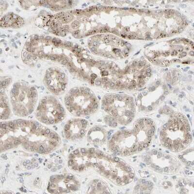 Immunohistochemistry-Paraffin: Granulin Antibody [NBP1-87324]