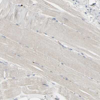 Immunohistochemistry-Paraffin: Granulin Antibody [NBP1-87324]