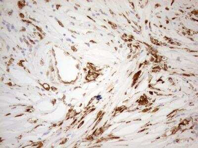 Immunohistochemistry-Paraffin: Granulin Antibody (OTI3H6) [NBP2-45915]