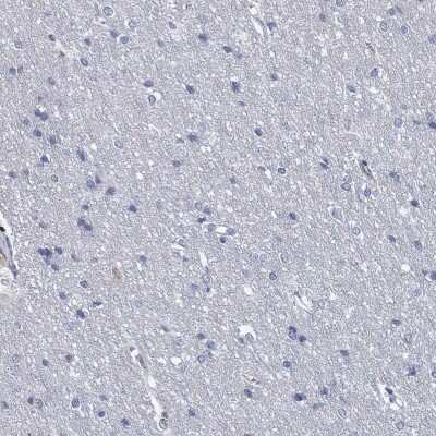 Immunohistochemistry-Paraffin: Granzyme A Antibody [NBP3-17018]