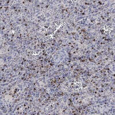 Immunohistochemistry-Paraffin: Granzyme A Antibody [NBP3-17018]