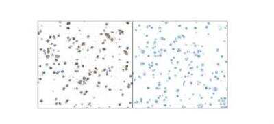 Immunocytochemistry/ Immunofluorescence: Granzyme B Antibody (BLR022E) [NBP2-76414]