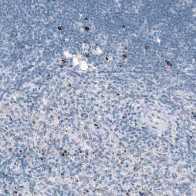 Immunohistochemistry-Paraffin: Granzyme B Antibody (CL10662) [NBP3-07984]