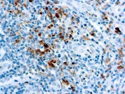 Immunohistochemistry-Paraffin: Granzyme B Antibody [NB100-684]