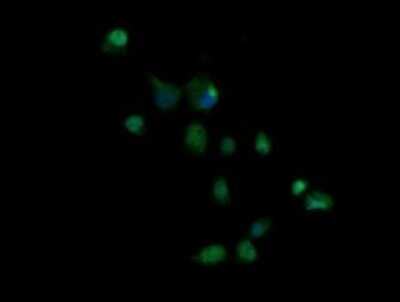 Immunocytochemistry/ Immunofluorescence: Granzyme B Antibody (OTI4E4) - Azide and BSA Free [NBP2-70870]
