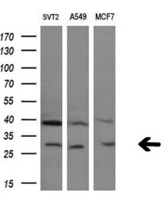 Western Blot: Granzyme B Antibody (OTI4E4) [NBP2-45732]