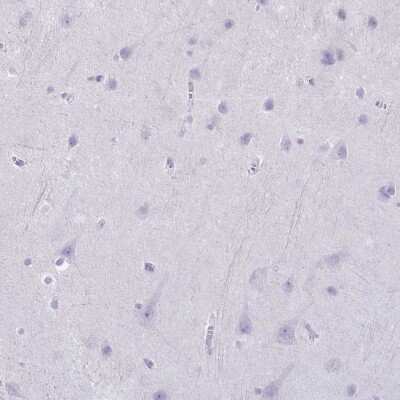 Immunohistochemistry-Paraffin: Granzyme K Antibody [NBP2-49387]