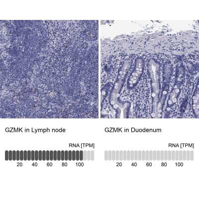 Immunohistochemistry-Paraffin: Granzyme K Antibody [NBP3-17052]