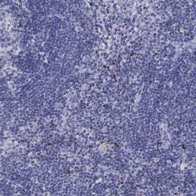 Immunohistochemistry-Paraffin: Granzyme K Antibody [NBP3-17052]
